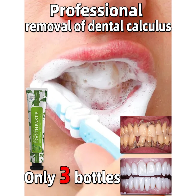 Removing Tartar Plaque Whitening Toothpaste Deep Cleaning Teeth Whitening Removing Oral Odor Preventing Periodontitis Oral Care
Removing Tartar Plaque Whitening Toothpaste Deep Cleaning Teeth Whitening Removing Oral Odor Preventing Periodontitis Oral Care