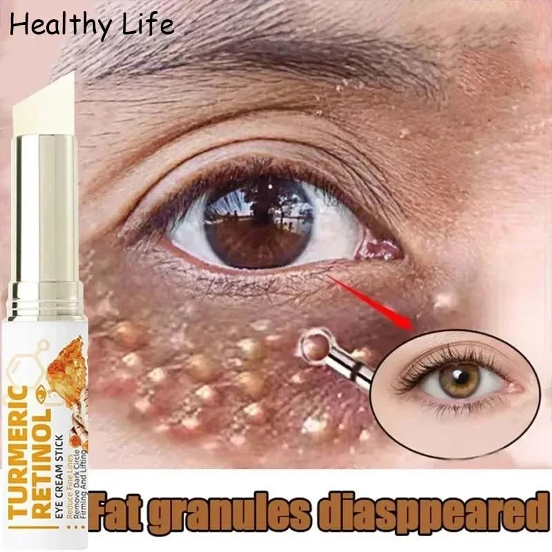 Anti Fat Particles Dark Circles Puffiness Fade Fine Lines Lift Brighten Korean Beauty Eye Care Instant Eye Bag Remove Eye Cream
Anti Fat Particles Dark Circles Puffiness Fade Fine Lines Lift Brighten Korean Beauty Eye Care Instant Eye Bag Remove Eye Cream