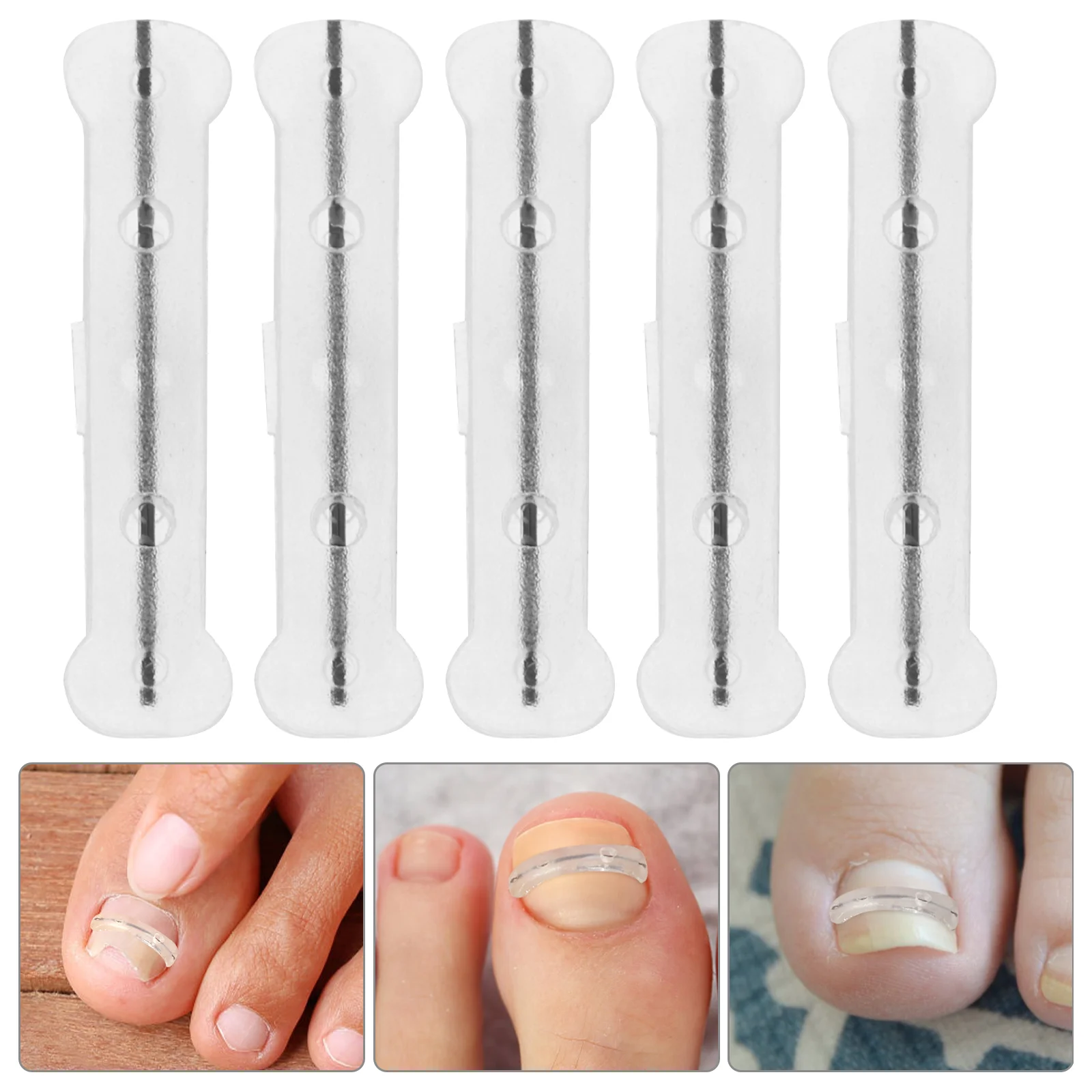 Nail Stickers Home Accessories Professional Correction Wire Household Toenail Corrector Small Daily Tool Ingrown Major
Nail Stickers Home Accessories Professional Correction Wire Household Toenail Corrector Small Daily Tool Ingrown Major