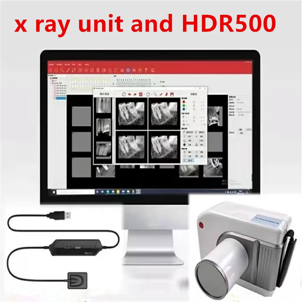 Good Feedback Dental X Ray Unit/High Frequency Portable dental X Ray machine With HDR 500A Sensor
Good Feedback Dental X Ray Unit/High Frequency Portable dental X Ray machine With HDR 500A Sensor