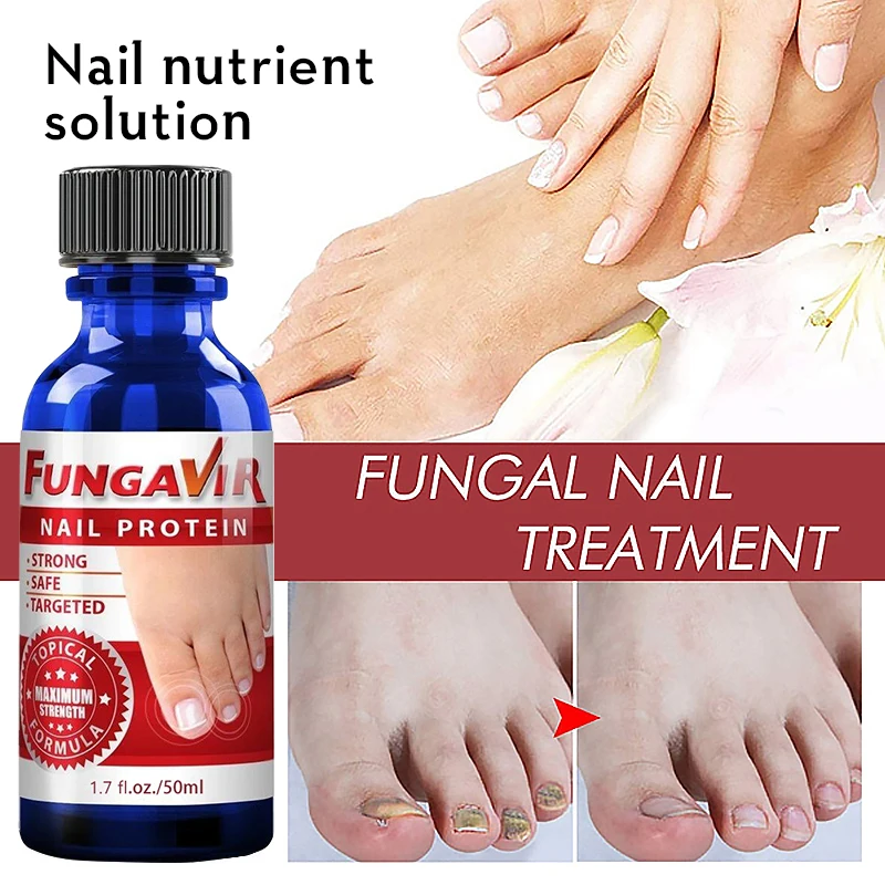 Nail Repair Serum Nail Fungal Treatment Serum Onychomycosis Paronychia Anti-Fungal Nail Infection Toe Fungus Foot Repair Care
Nail Repair Serum Nail Fungal Treatment Serum Onychomycosis Paronychia Anti-Fungal Nail Infection Toe Fungus Foot Repair Care
