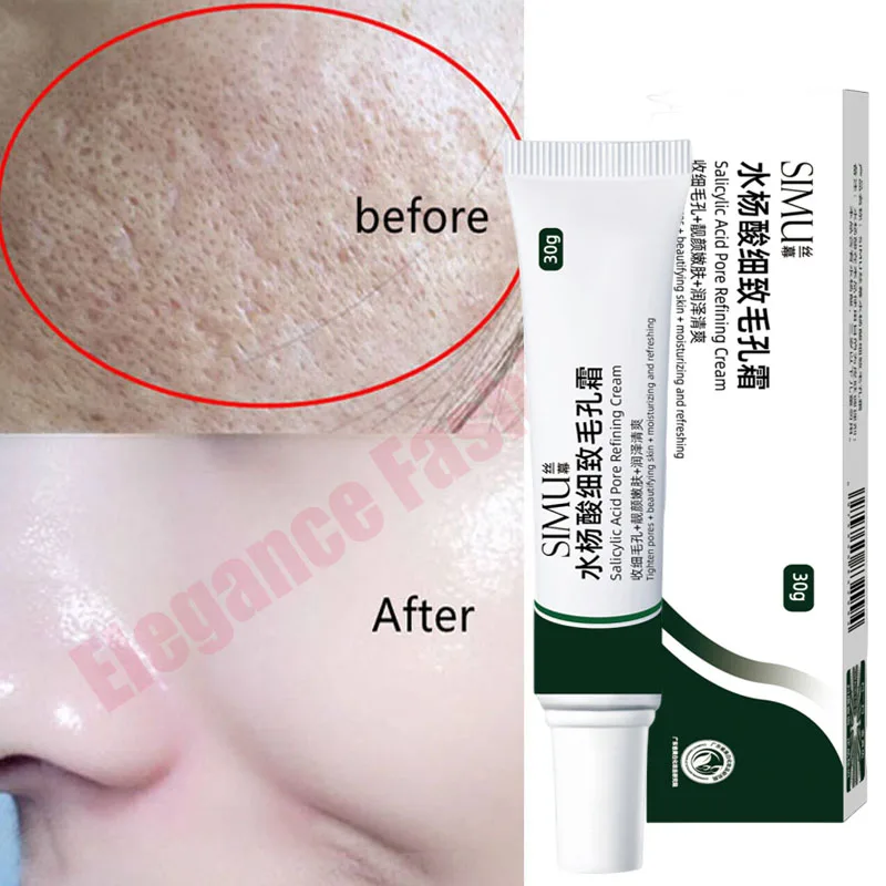 Salicylic Acid Pores Shrink Refining Cream Treatments Large Open Pore Remove Black Dots Blackhead Acne Marks Face Skin Products
Salicylic Acid Pores Shrink Refining Cream Treatments Large Open Pore Remove Black Dots Blackhead Acne Marks Face Skin Products
