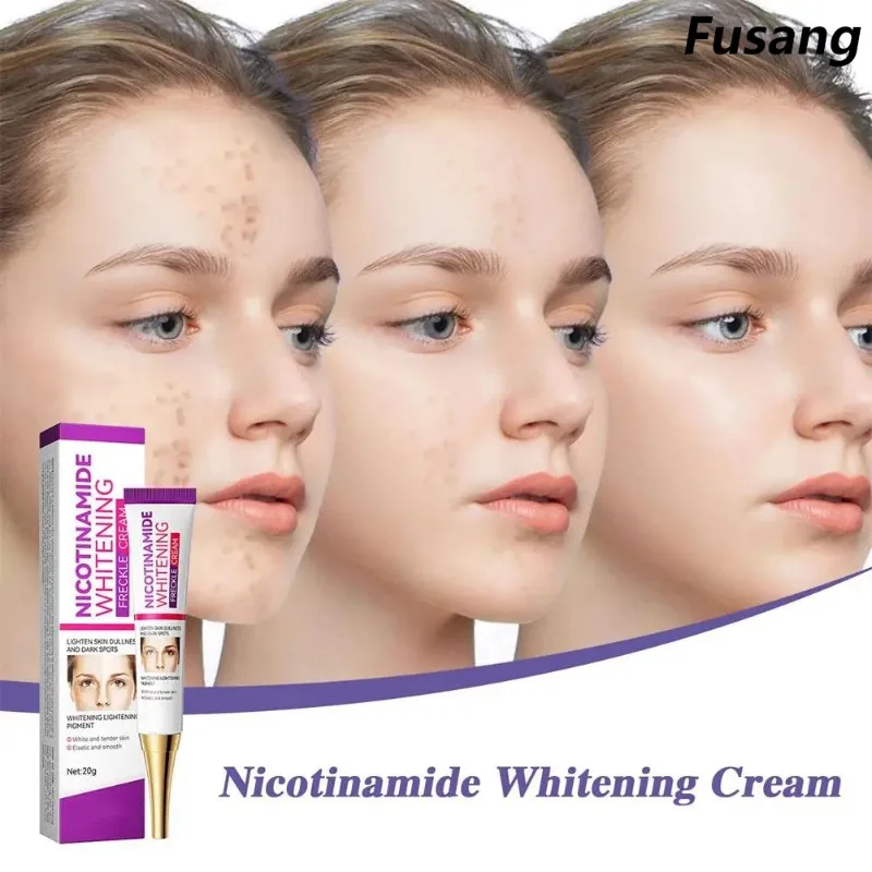 Nicotinamide Whitening Freckles Cream Powerful Remove Melasma Dark Spot Cream Fade Acne Marks Brightening Skin Face Skin Care
Nicotinamide Whitening Freckles Cream Powerful Remove Melasma Dark Spot Cream Fade Acne Marks Brightening Skin Face Skin Care