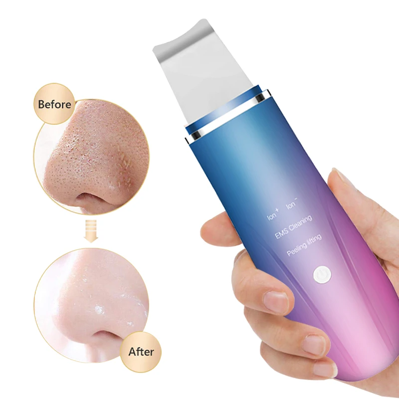 2022 Hot Ultra Sonic Facial Exfoliator Skin Scrubber Beauty Care Ems Ultrasonic Ion Skin Lifting Scrubber Peeling Beauty Device
2022 Hot Ultra Sonic Facial Exfoliator Skin Scrubber Beauty Care Ems Ultrasonic Ion Skin Lifting Scrubber Peeling Beauty Device