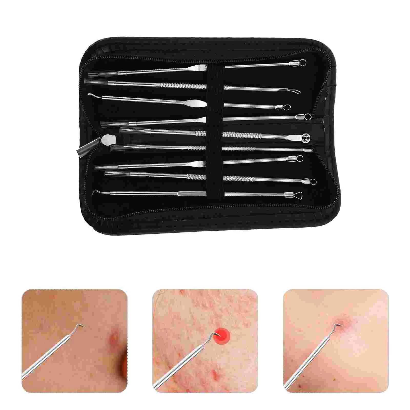 

9pcs/Set Needle Blackhead Sucker Face Skin Care Tool Zit Removing Tools Pore Extractor Double- End Needles Pimple Acne extruder