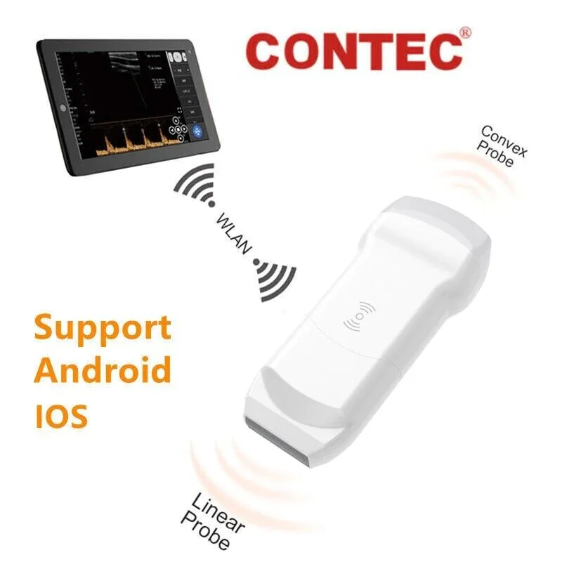 CONTEC CMS1600A, Цветной Допплер, ультразвуковая диагностическая система, выпуклая линейная 2 зонда
CONTEC CMS1600A, Цветной Допплер, ультразвуковая диагностическая система, выпуклая линейная 2 зонда