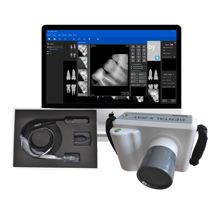 Wholesale Oral X ray machine unit factory prices with High Clear Imaging System USB Xray Dental Sensor
Wholesale Oral X ray machine unit factory prices with High Clear Imaging System USB Xray Dental Sensor