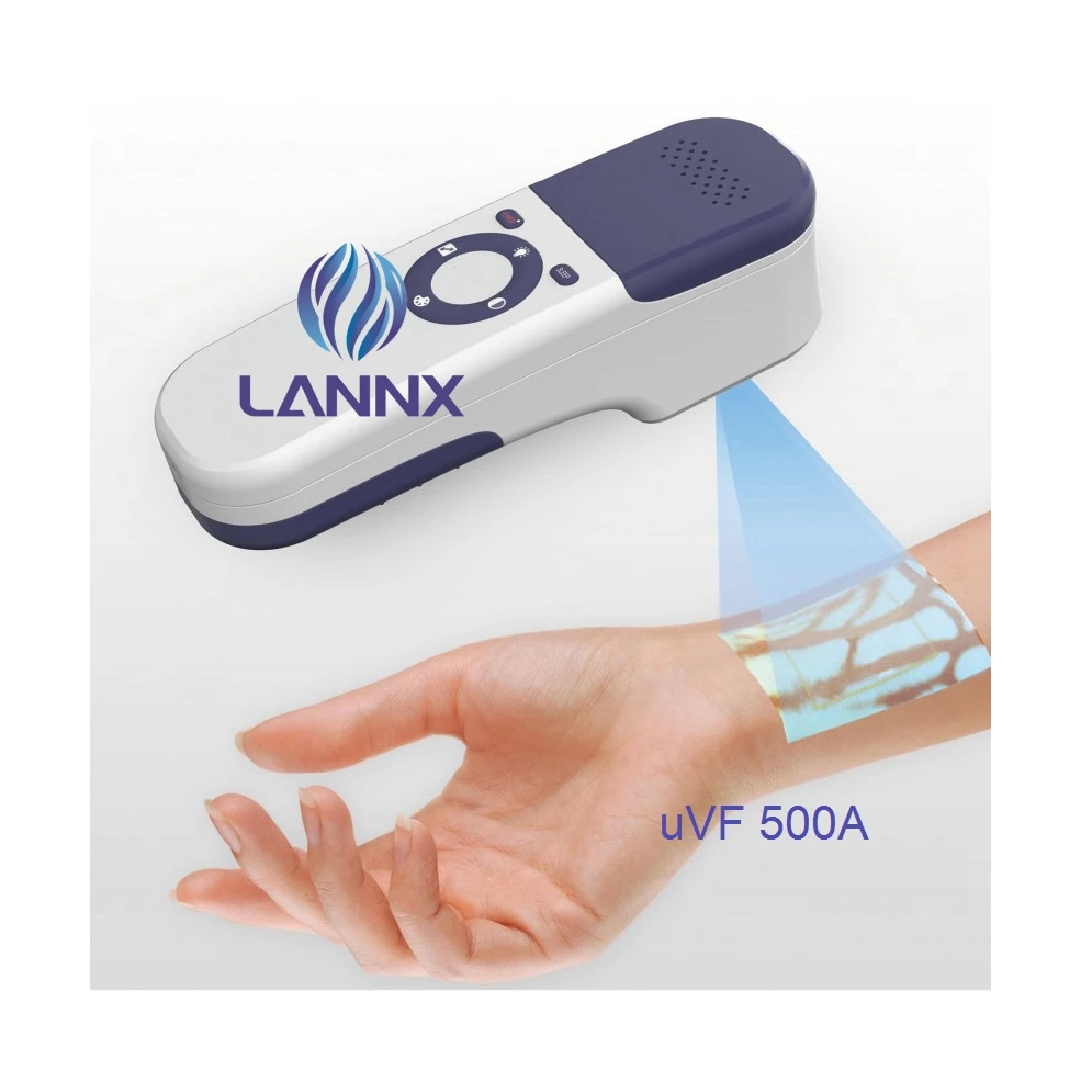 

LANNX uVF 500A Medical vein finder for blood collection needles puncture Locate veins Hospital Scanner Test vein finder detector