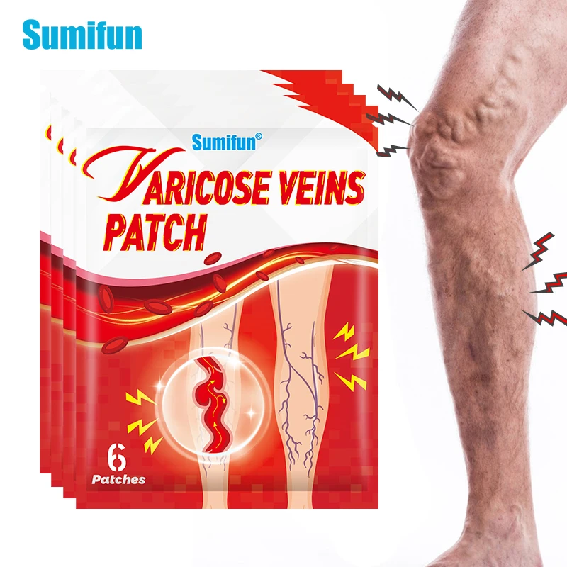 

6/12/24pcs Sumifun Varicose Veins Patch Vasculitis Phlebitis Spider Varicosity Angiitis Stickers Removal Herbal Medical Plaster