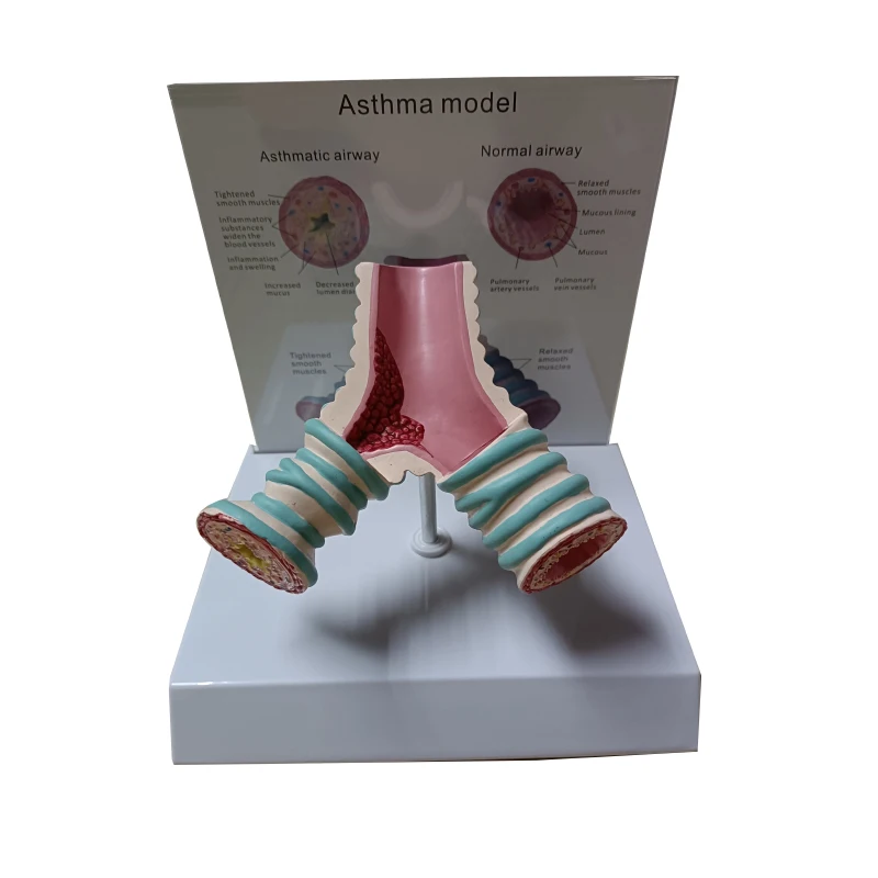 Asthma model Morbid comparative medical teaching doctor-patient explanation model
Asthma model Morbid comparative medical teaching doctor-patient explanation model