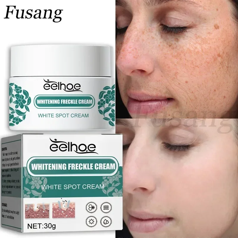 Vitamin C Whitening Remove Spots Cream Brightens Reduces Dark Spots Freckle Cream Melasma Melanin Remover Women Facial Skin Care
Vitamin C Whitening Remove Spots Cream Brightens Reduces Dark Spots Freckle Cream Melasma Melanin Remover Women Facial Skin Care