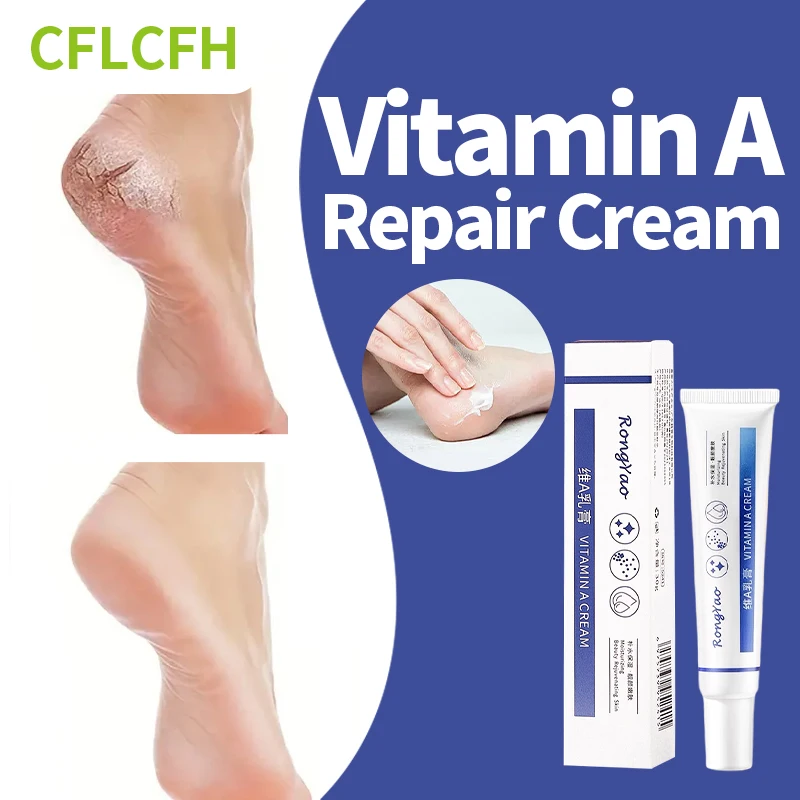

Anti Crack Foot Cream Drying Cracked Feet Treatment Heel Dead Skin Removal Moisturizing Repair Hand Foot Care Vitamin A Mask 30g