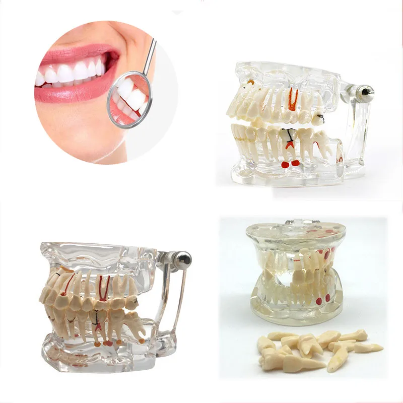 1pcs Dental Teaching Model Doctor-Patient Communication Model Dental Comprehensive Pathology Model Detachable Model Repair Model
1pcs Dental Teaching Model Doctor-Patient Communication Model Dental Comprehensive Pathology Model Detachable Model Repair Model