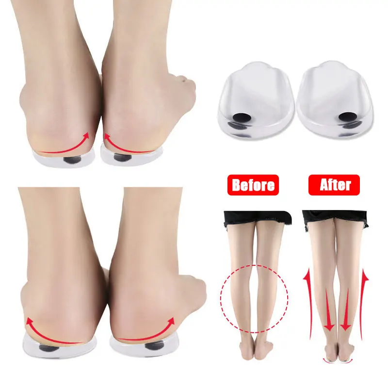 Silicone Orthopedic Insoles for Feet O/X Leg Type Valgus Varus Correction Plantar Fasciitis Gel Insole Magnet Massage Foot Care
Silicone Orthopedic Insoles for Feet O/X Leg Type Valgus Varus Correction Plantar Fasciitis Gel Insole Magnet Massage Foot Care
