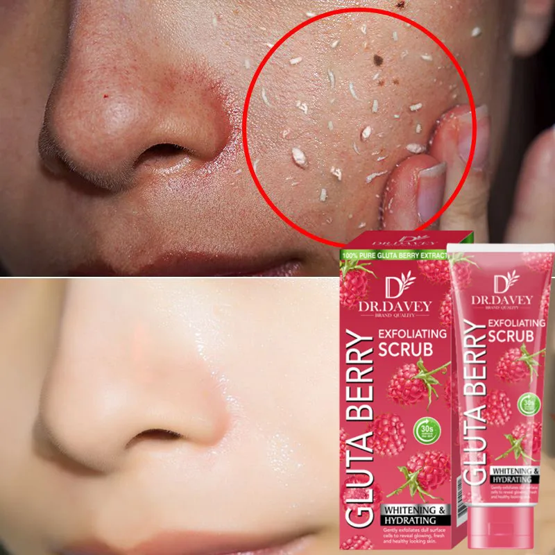 

120G 100% Pure Gluta Berry Extract Face Exfoliating Whitening Remove Dead Skin Blackhead Body Scrub Cleaner Anti Cellulite Acne