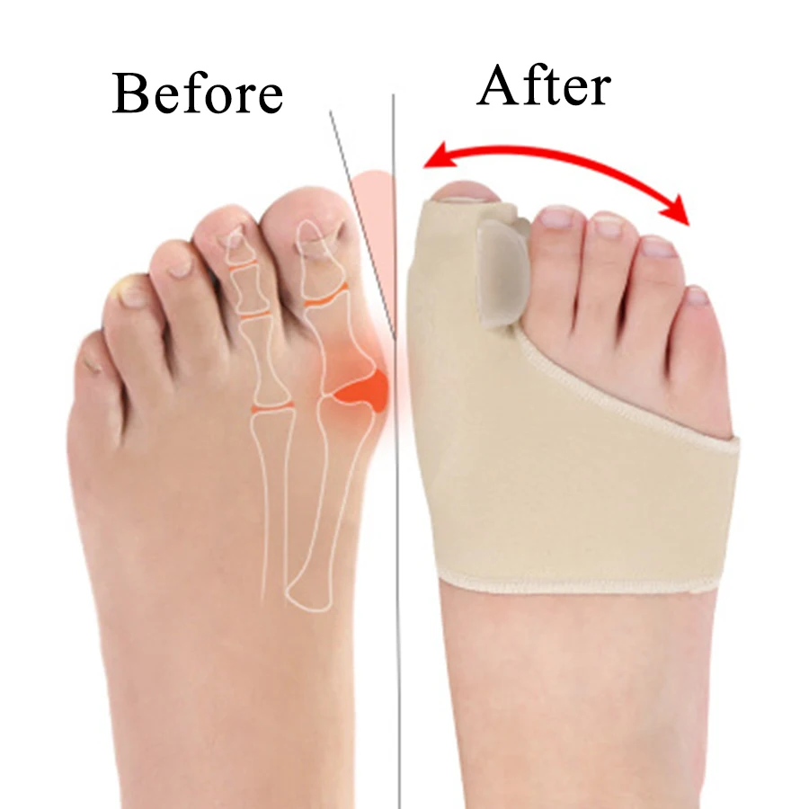 New Bunion Straighteners and Toe Separators Foot Pain Relief For Men And Women
New Bunion Straighteners and Toe Separators Foot Pain Relief For Men And Women