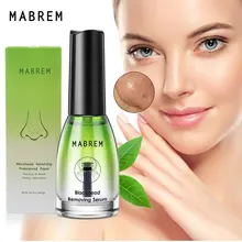 Removed Blackhead Deep Pore Cleaning Oil-Control Nose Black Dots Mask Acne Deep Cleansing Beauty Cosmetics for Women Skin Care
Removed Blackhead Deep Pore Cleaning Oil-Control Nose Black Dots Mask Acne Deep Cleansing Beauty Cosmetics for Women Skin Care
