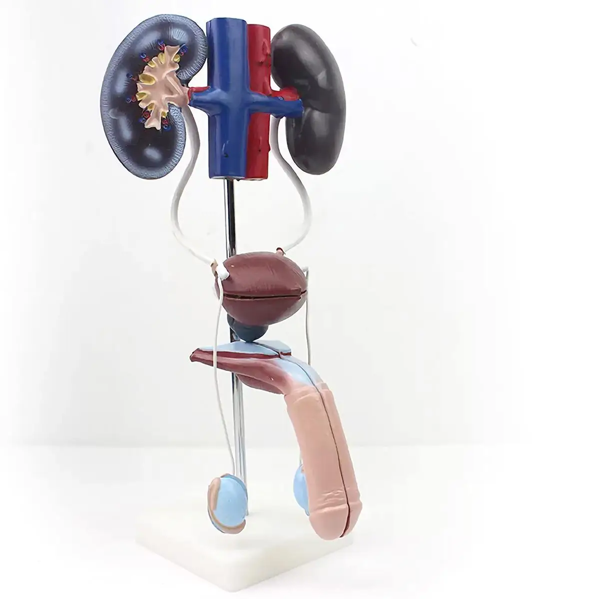 3 Parts Human Male Stereourinary Kidney Ureter Bladder Model Surgeon Medical School
3 Parts Human Male Stereourinary Kidney Ureter Bladder Model Surgeon Medical School
