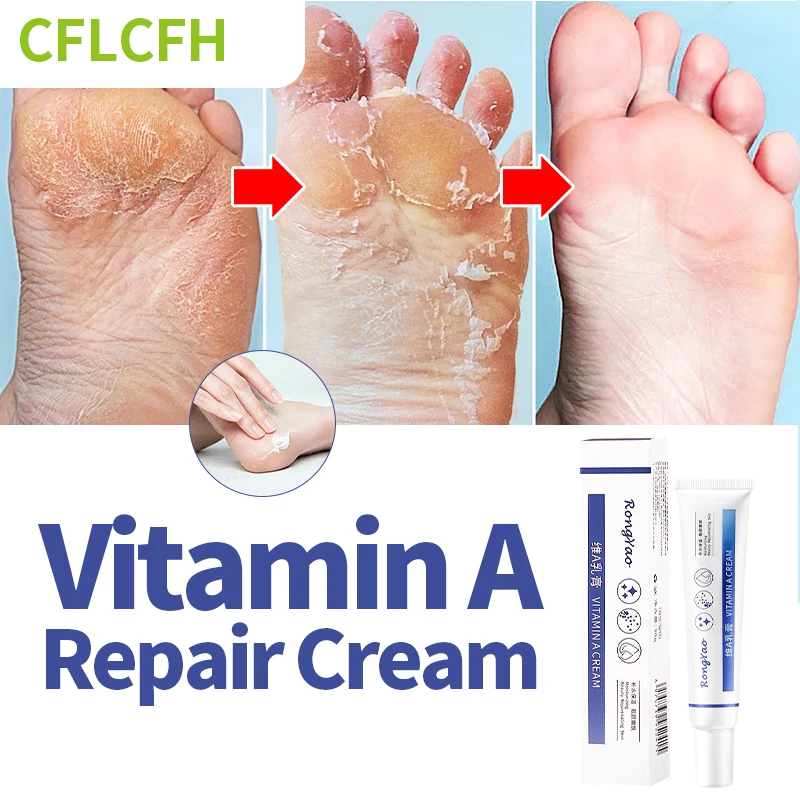 

Anti Crack Foot Cream Drying Cracked Feet Repair Hand Heel Dead Skin Removal Treatment Moisturizing Care Vitamin A Foot Mask 30g