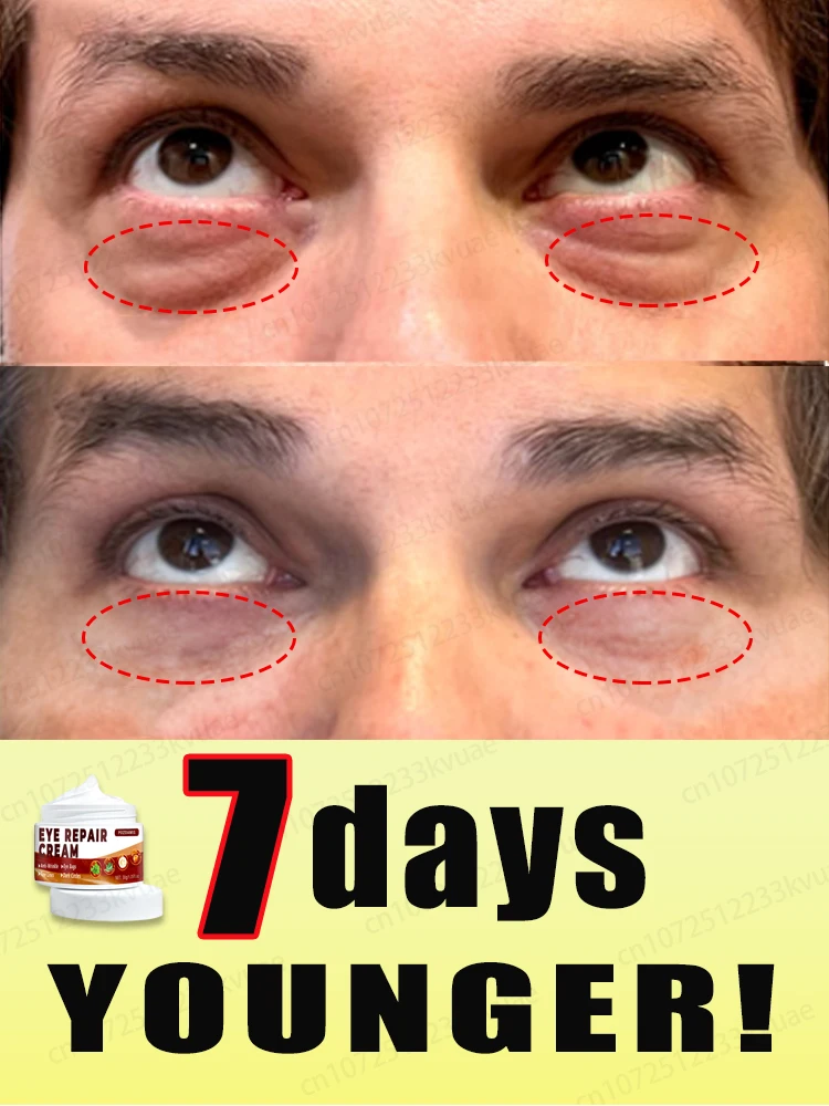 Quickly eliminate wrinkles, eye bags, reduce dark circles, and make yourself more confident and beautiful
Quickly eliminate wrinkles, eye bags, reduce dark circles, and make yourself more confident and beautiful