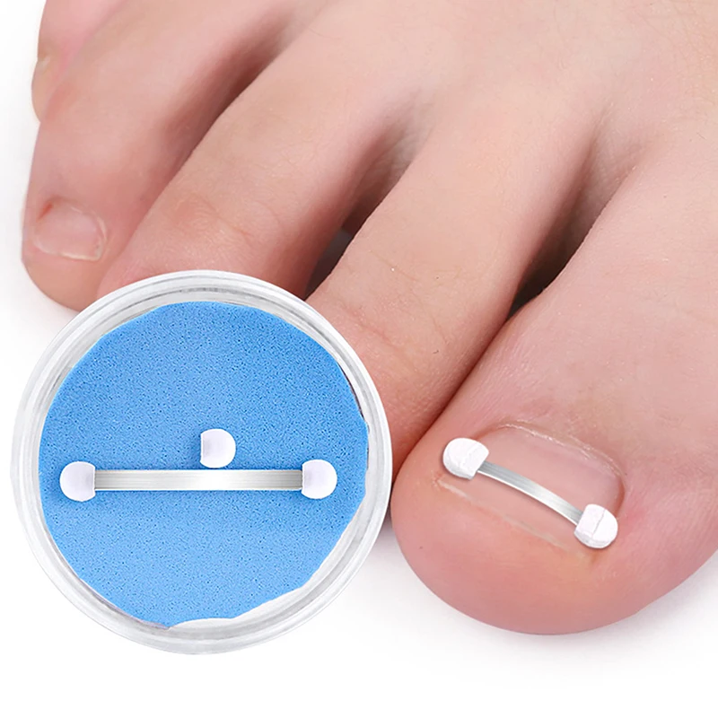 

Ingrown Toe Nail Treatment Ingrown Toenail Correction Tool Elastic Patch Sticker Straightening Clip Brace Pedicure Tools