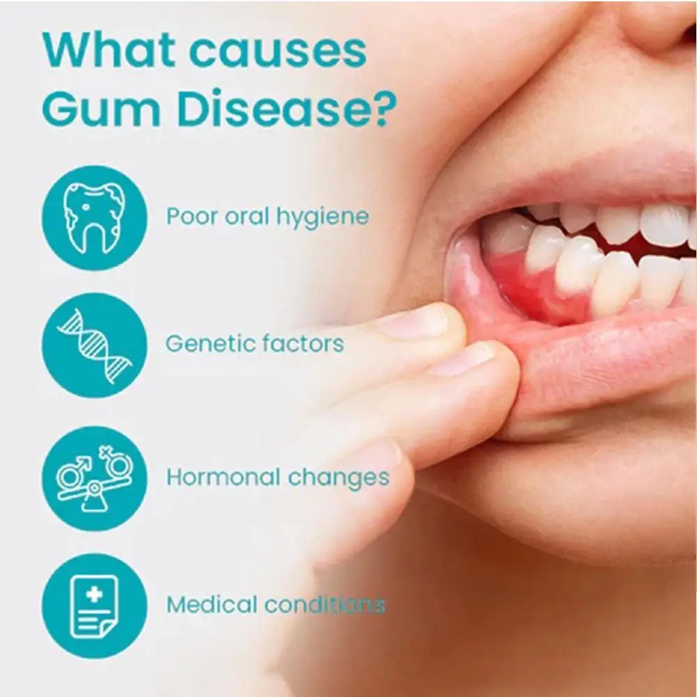 Gum Repair Gel Rebuilding Strengthen Whiten Remove Gingival Breath Recession Anti Inflammation Bad Stains Protect Oral Gel T2X6
Gum Repair Gel Rebuilding Strengthen Whiten Remove Gingival Breath Recession Anti Inflammation Bad Stains Protect Oral Gel T2X6