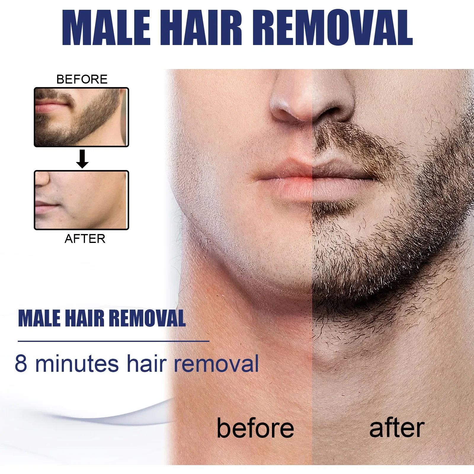 Sdotter Permanant Stop Hair Growth Lavender Hair inhibitor Cream skin Care for Beard Bikini Intimate Armpit Leg Powerful Removal
Sdotter Permanant Stop Hair Growth Lavender Hair inhibitor Cream skin Care for Beard Bikini Intimate Armpit Leg Powerful Removal