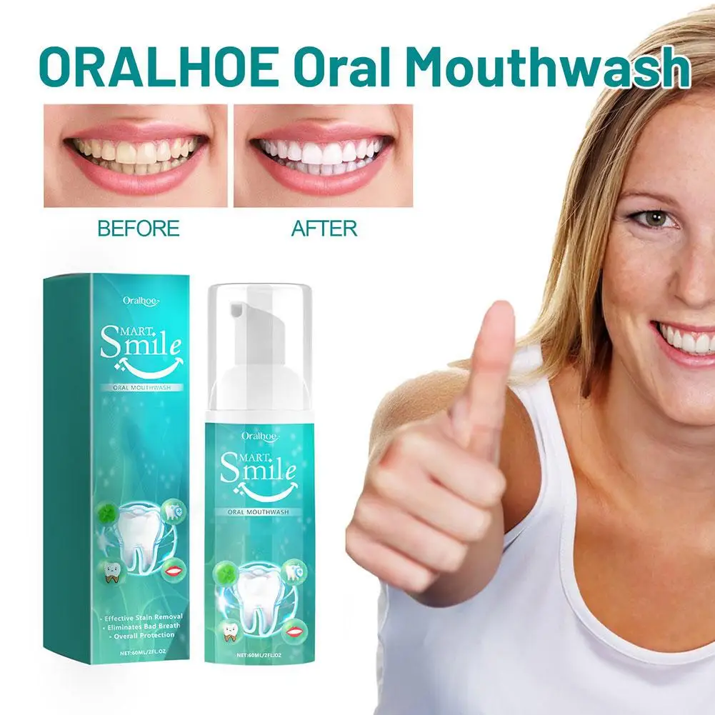 Teeth Cleansing Mousse Remove Plaque Stains Breath Gingival Repair Whitening Freshen Oral Foam Dental Toothpaste Hygiene Ca E8M4
Teeth Cleansing Mousse Remove Plaque Stains Breath Gingival Repair Whitening Freshen Oral Foam Dental Toothpaste Hygiene Ca E8M4