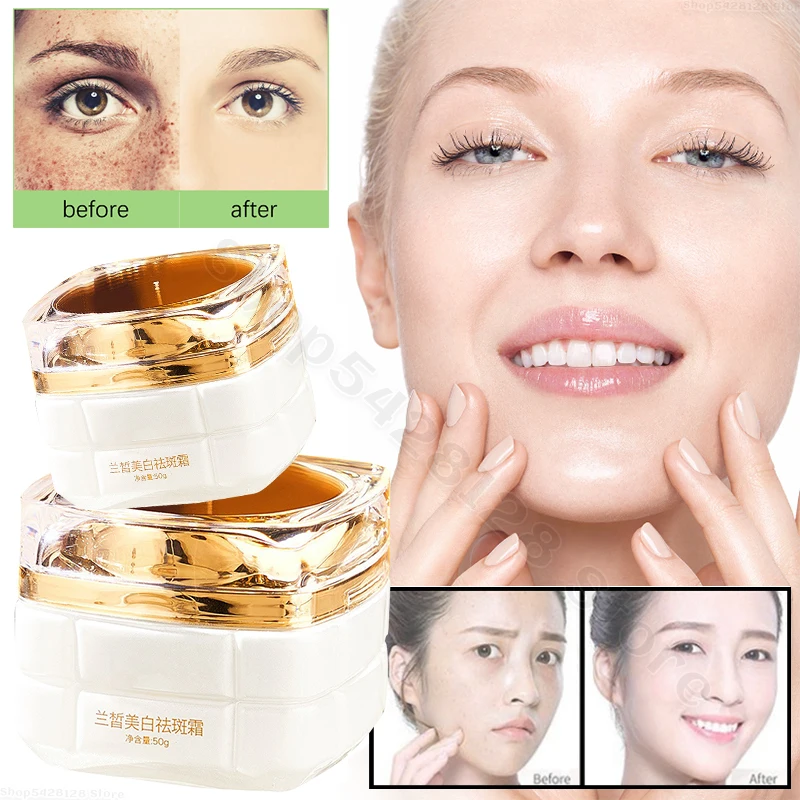 Whitening and Anti-freckle Cream Fades Fine Lines Moisturizes and Smoothes Improves Dry Skin Whitening and Moisturizing Cream
Whitening and Anti-freckle Cream Fades Fine Lines Moisturizes and Smoothes Improves Dry Skin Whitening and Moisturizing Cream