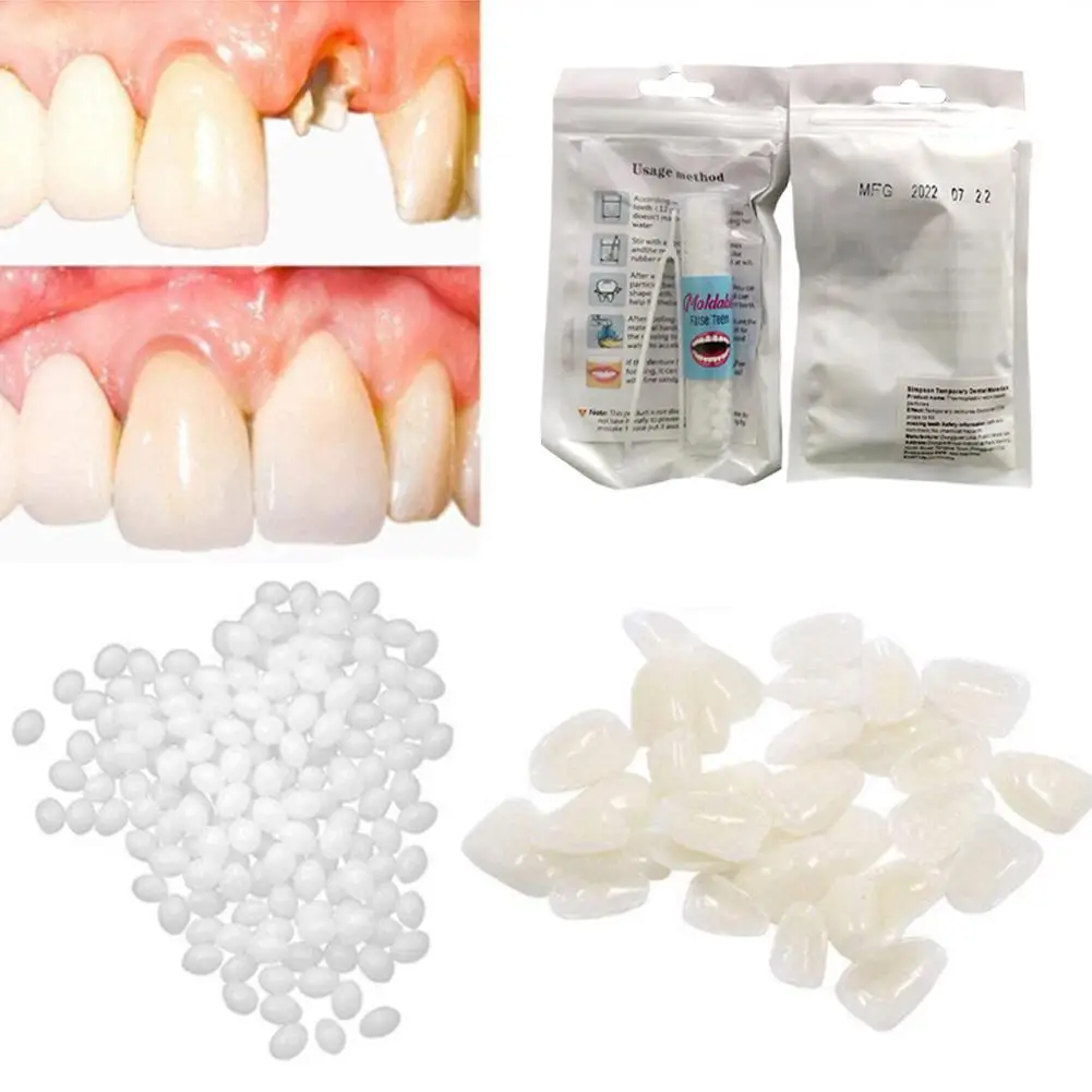 

5g/10/15/20g набор для временного ремонта зубов, полимерные зубные зазоры, наполнение, формируемый клей, клей для зубных протезов, Стоматологические принадлежности для красоты