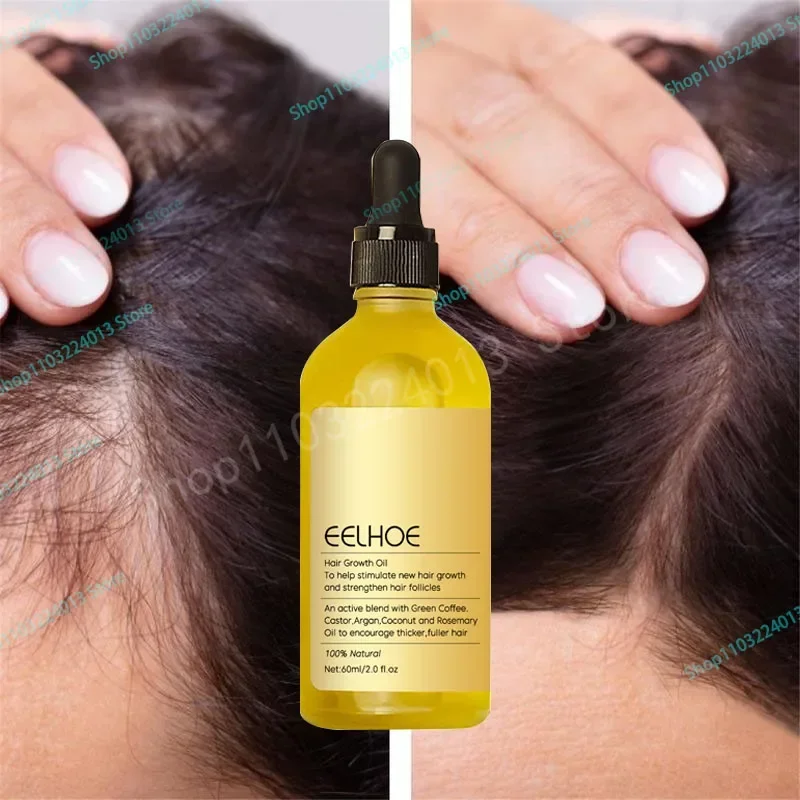 

Sdotter новые продукты для роста волос с сильным эффектом имбирное эфирное масло 2 недели лечение выпадения волос восстановление кожи головы питание корней волос Regro