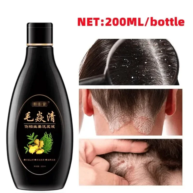 Scalp Hair Follicle Mite Removal Shampoo Antibacterial Antipruritic Oil Control Seborrheic Dermatitis Hair Scalp Cleansing
Scalp Hair Follicle Mite Removal Shampoo Antibacterial Antipruritic Oil Control Seborrheic Dermatitis Hair Scalp Cleansing