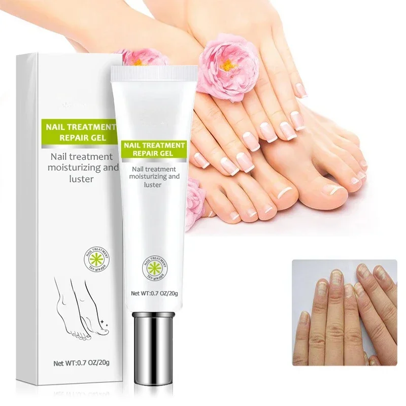 3pcs 20ml Exfoliation, nail repair night Efero Nail Cream Treatment Repair Gel Moisturizing and Luster
3pcs 20ml Exfoliation, nail repair night Efero Nail Cream Treatment Repair Gel Moisturizing and Luster