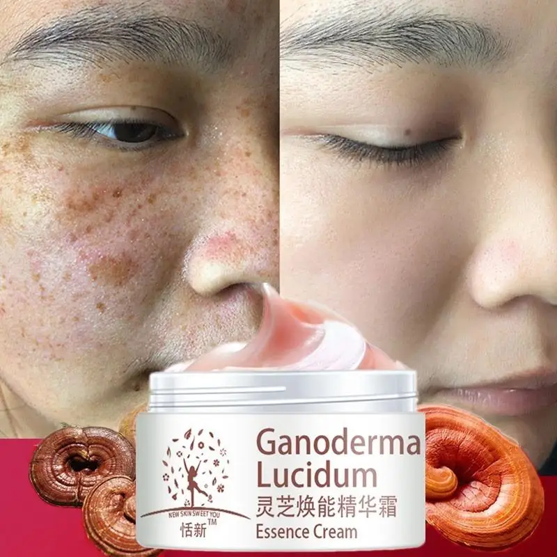 Ganoderma Face Cream Freckle Remove Repair Facial Moisturizing Brightening Cream Lucidum Anti-aging Cream
Ganoderma Face Cream Freckle Remove Repair Facial Moisturizing Brightening Cream Lucidum Anti-aging Cream
