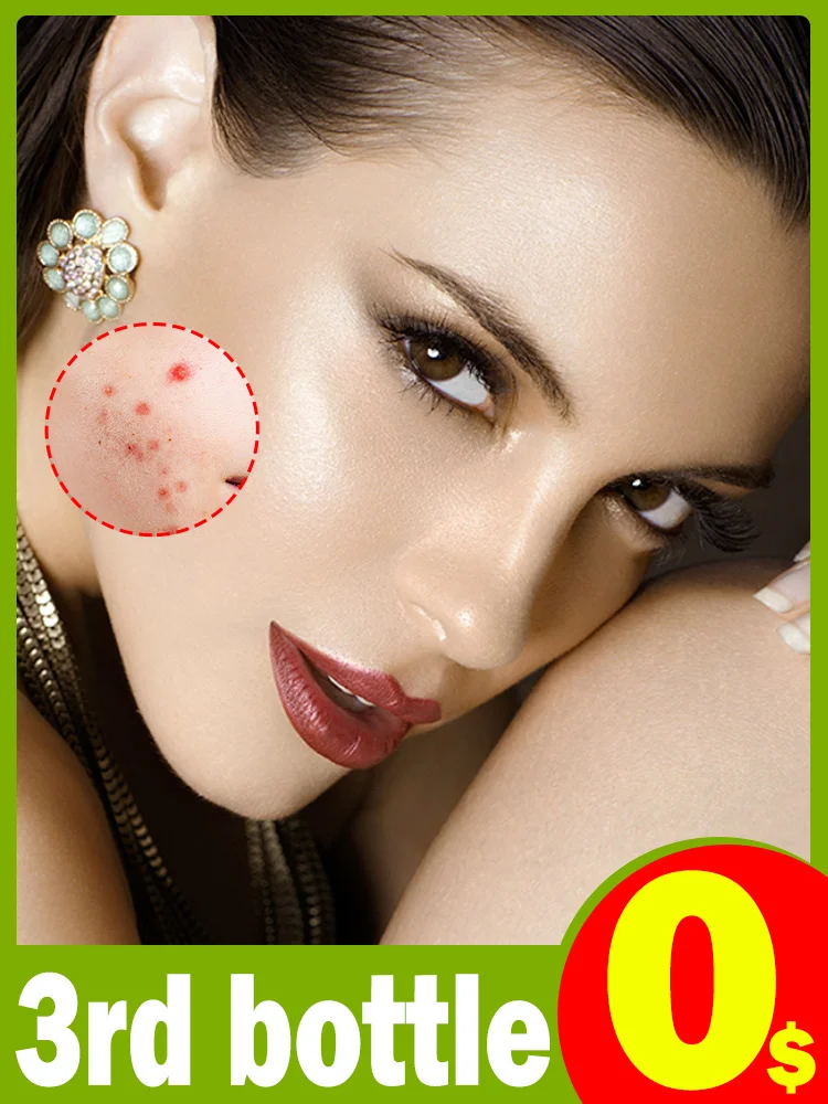 Гиалуроновая кислота против акне, сыворотка для лица, Ниацинамид, оригинальный увлажняющий лучший корейский продукт для здоровья и красоты, уход за кожей, эссенция
Гиалуроновая кислота против акне, сыворотка для лица, Ниацинамид, оригинальный увлажняющий лучший корейский продукт для здоровья и красоты, уход за кожей, эссенция