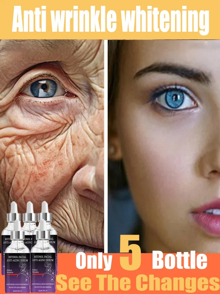 Instant Anti Wrinkle Aging Effect Remove Facial Wrinkles Fade Fine Lines Firming Tightening Face Skin Care Korea Cosmetic
Instant Anti Wrinkle Aging Effect Remove Facial Wrinkles Fade Fine Lines Firming Tightening Face Skin Care Korea Cosmetic