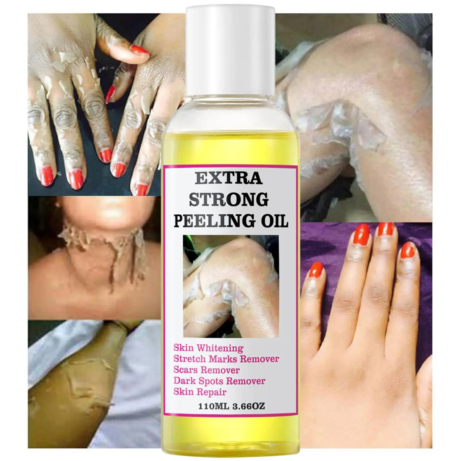 Yellow Peeling Oil For Dark Skin Bleaching Whitening Elbows Knees Hands Lightening Scrub Exfoliating Dead Skin Care W0K3
Yellow Peeling Oil For Dark Skin Bleaching Whitening Elbows Knees Hands Lightening Scrub Exfoliating Dead Skin Care W0K3