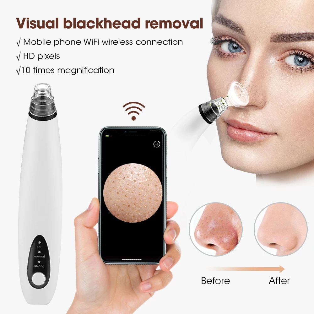 

WiFi Visual Electric Blackhead Remover Vacuum Acne Cleaner Black Spots Removal Facial Deep Cleansing Pore Cleaner Machine