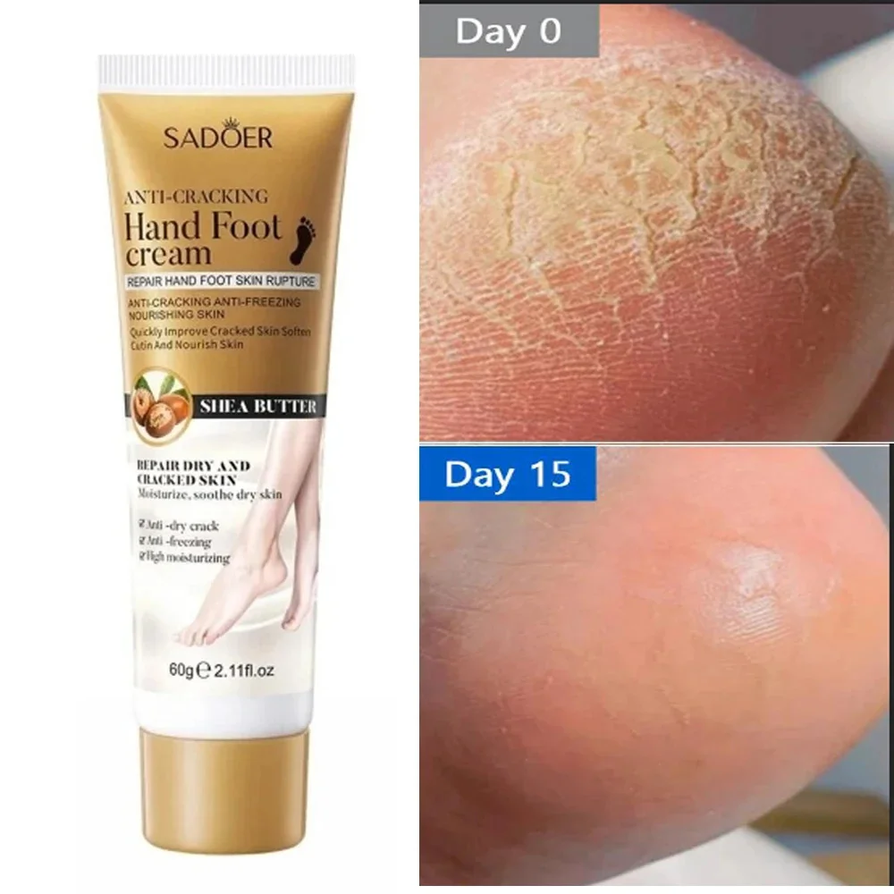 

Anti Crack Hand Foot Cream Anti-Drying Heel Cracked Repair Feet Mask Removal Dead Skin Moisturizing Whitening Feet Care Products