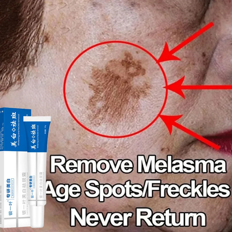 Mild Niacinamide Whitening Freckle Cream Effectively Lightens Black Spots Acne Marks Removes Melasma Brightens Skin Care New
Mild Niacinamide Whitening Freckle Cream Effectively Lightens Black Spots Acne Marks Removes Melasma Brightens Skin Care New