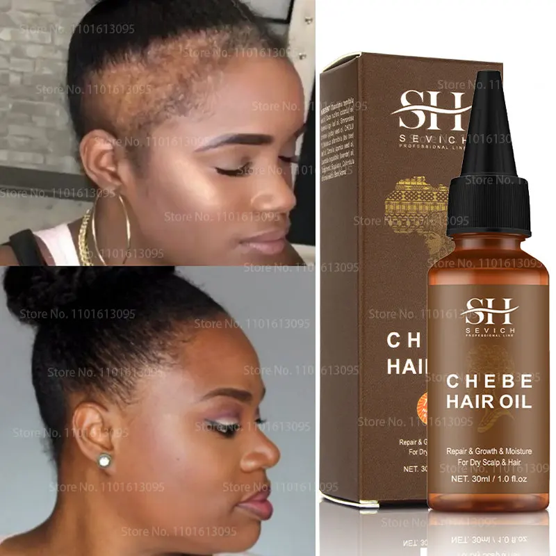 

African Chebe Oil Hair Strengthener Chebe Extreme Fast Edges Hair Growth Oil Alopecia Hair Oil 30ml