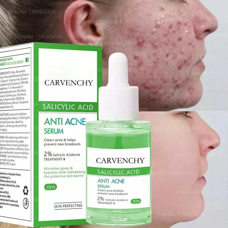 Facial Anti Acne Serum Acne Removal Hyaluronic Moisturizing Shrink Pores Oil-control Acne Face Korean Skin Care Product
Facial Anti Acne Serum Acne Removal Hyaluronic Moisturizing Shrink Pores Oil-control Acne Face Korean Skin Care Product