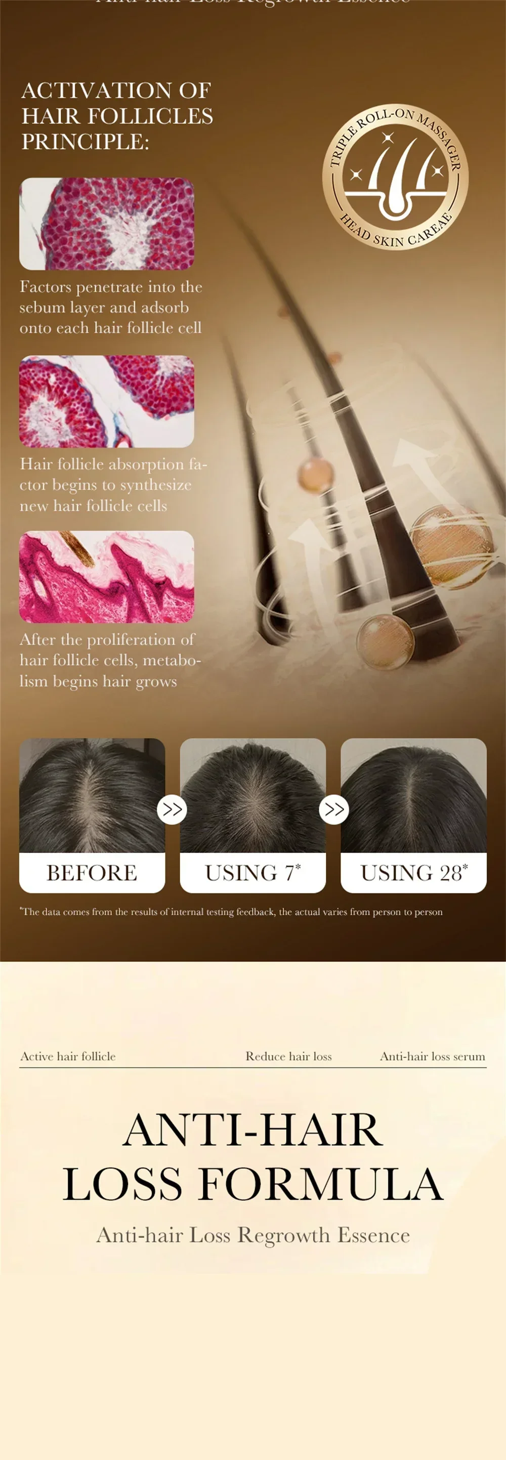 biotina para crecimiento de cabello, productos de aceite para el crecimiento rápido del cabello, tratamientos para el masaje del cuero cabelludo, antipérdida de cabello, suero para el cabello más grueso y eficaz para hombres 12 biotina para crecimiento de cabello biotina para crecimiento de cabello, productos de aceite para el crecimiento rápido del cabello, tratamientos para el masaje del cuero cabelludo, antipérdida de cabello, suero para el cabello más grueso y eficaz para hombres » biotina para crecimiento de cabello