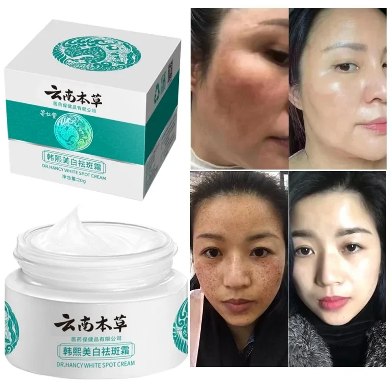 Whitening Spot Cream Anti Aging Face Cream Skin Care Freckles Cream Remove Melanin and Black Spots Skin Fade Spots Moisturizing
Whitening Spot Cream Anti Aging Face Cream Skin Care Freckles Cream Remove Melanin and Black Spots Skin Fade Spots Moisturizing