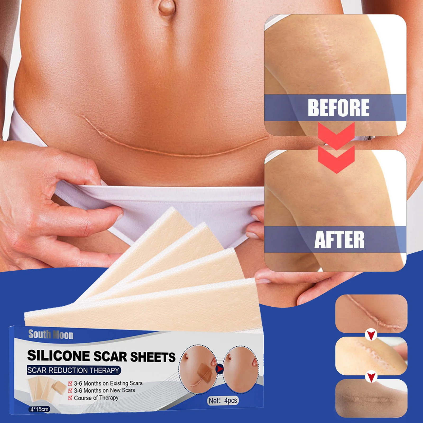 self-adhesive scar removing paste silicone paste laparotomy scar paste scalding operation scar smoothing skin wound repair paste
self-adhesive scar removing paste silicone paste laparotomy scar paste scalding operation scar smoothing skin wound repair paste