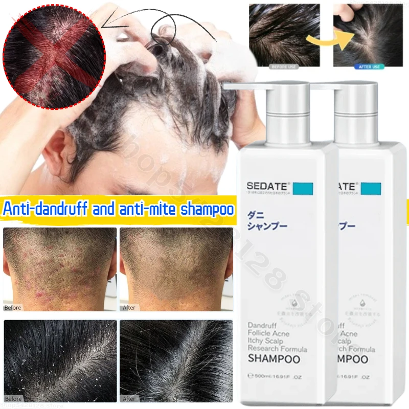 

Deep Cleansing Antibacterial Mite Removal Hair Follicle Repair Shampoo Oil Control Fluffy Anti-dandruff Anti-itch Shampoo 500ml