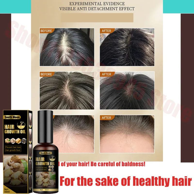 

Ginger Hair Growth Essential Oil Natural Anti Hair Loss Products Fast Grow Prevent Baldness Treatment Germinal Liquid Men Women