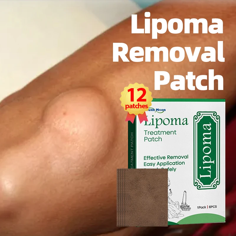 Lipoma Remover Patch Fibroma Cellulite Removal Solitary Multiple Lipoma Scyst Fat Lump Fat Mass Treatment Hua Tuo Medicine
Lipoma Remover Patch Fibroma Cellulite Removal Solitary Multiple Lipoma Scyst Fat Lump Fat Mass Treatment Hua Tuo Medicine