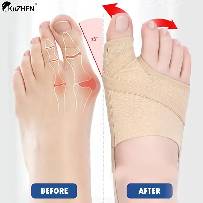 

1Pair Big Toe Separator Hallux Valgus Bunion Corrector Orthotics Feet Bone Thumb Adjuster Correction Pedicure Sock Straightener