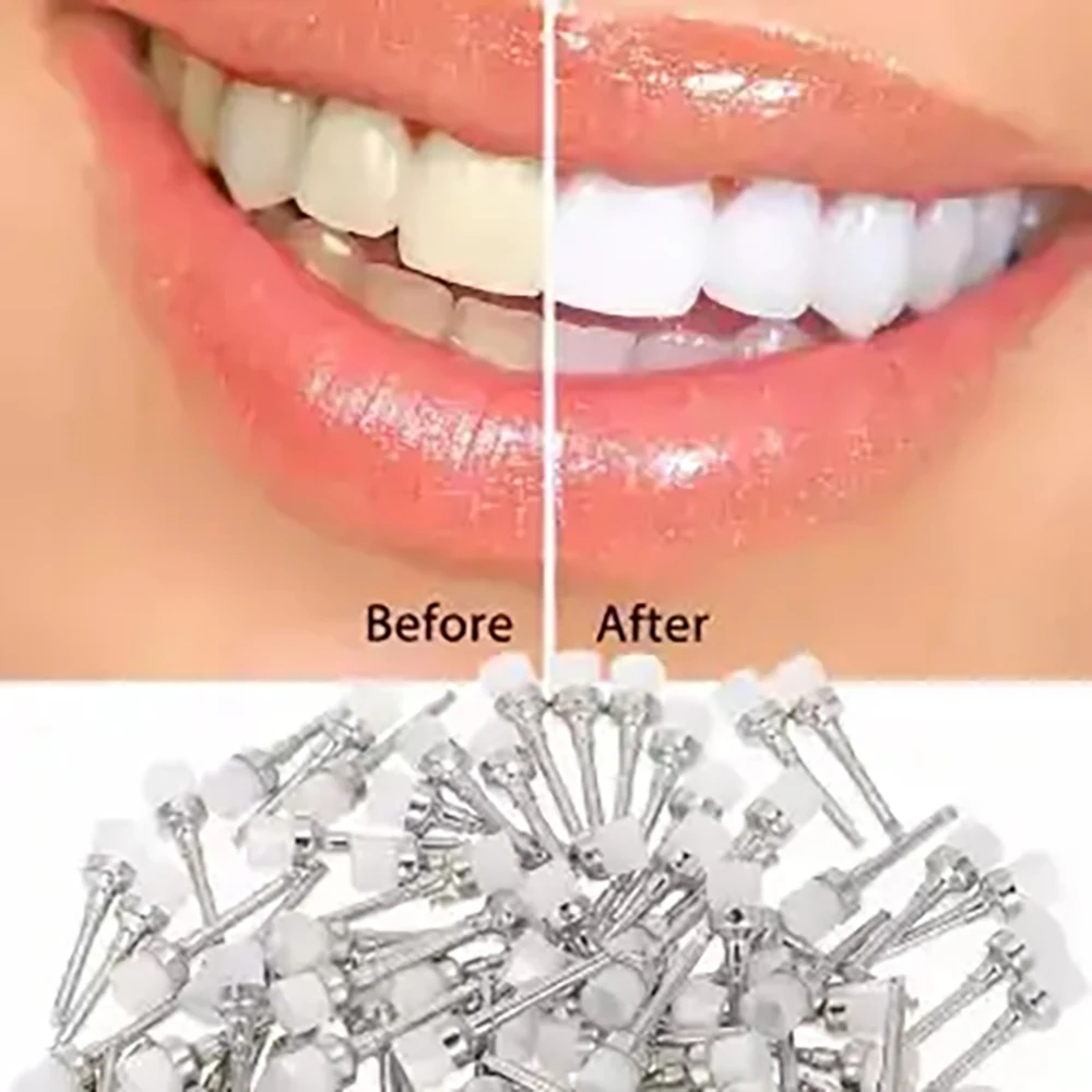 Disposable Oral Plastic Consumables Polishing Nylon Bristle Polisher Bowl Shape Dental Prophy Brushes Stain Removal Tool 10 Mallzona S899c10618a65414dbb6b8e0b14c9419dZ Disposable Oral Plastic Consumables Polishing Nylon Bristle Polisher Bowl Shape Dental Prophy Brushes Stain Removal Tool Mallzona